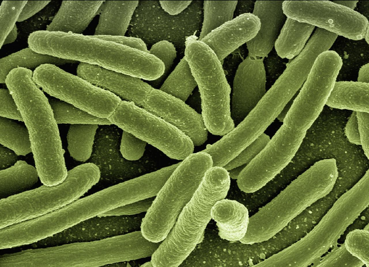  Legionella